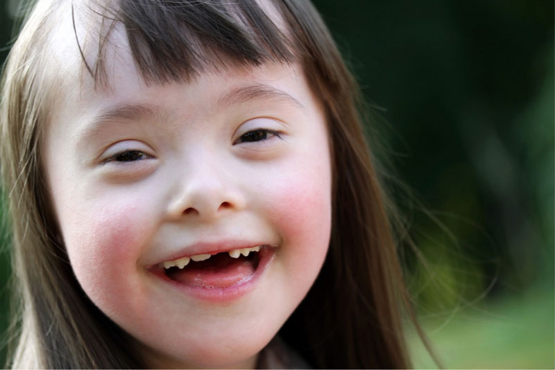 Special Needs Dental Care for Children