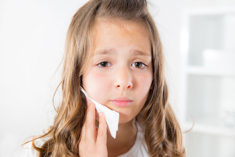 Tooth Extractions for Kids